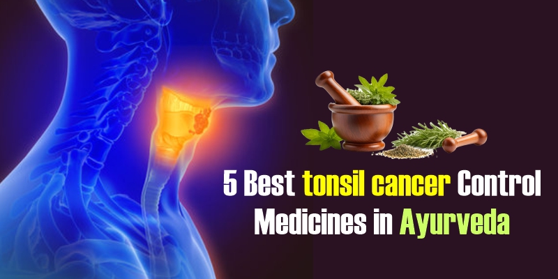 5 Best Tonsil Cancer Control Medicines in Ayurveda